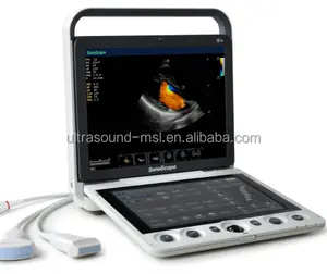 Sonoscape S9 High-End Hand Uitgevoerd Kleur Doppler Vergelijkbaar Met Mindray M7 Ultrasound Machine