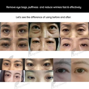 Private Label <strong>Instant</strong> Reducing Puffiness Wrinkles <strong>Eye</strong> <strong>Bag</strong> <strong>Removal</strong> Ageless <strong>Eye</strong> <strong>Cream</strong> in 2 Minutes - Product Image 3