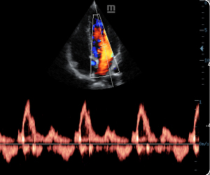 Máy siêu âm Doppler màu <span class=keywords><strong>4D</strong></span> Mindray Mindray Dc-30 - Product Image 5