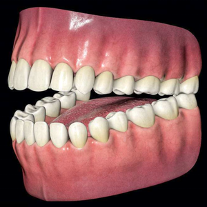 <span class=keywords><strong>PEEK</strong></span> peletler diş protez - Product Image 3