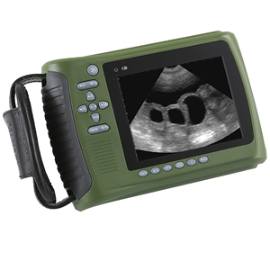 Palmtop Échographe Vétérinaire - Product Image 4