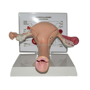 महिला गर्भाशय एनाटॉमी मॉडलः चिकित्सा प्रशिक्षण के लिए जीवन-आकार - Product Image 2