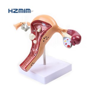 Модель обучения медицинской науке пластиковая модель влагалища матки - Product Image 3