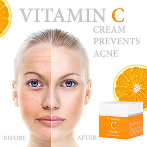 Marque privée <span class=keywords><strong>Anti</strong></span>-âge Dissolvant Taches Noires <span class=keywords><strong>Meilleure</strong></span> Crème Hydratante Blanchissante à la Vitamine C du Visage pour la Peau - Product Image 6