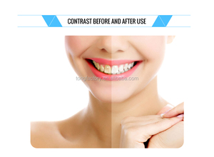 Peróxido de hidrógeno, Kit de blanqueamiento de dientes logotipo privado Blanqueamiento Dental doble Gel blanqueador de - Product Image 6