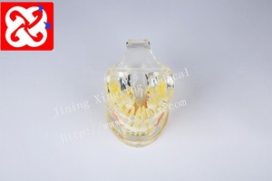 Mezcla de dentición modelo dental con los dientes permanentes y desdentado dientes de bebé y de retención - Product Image 6