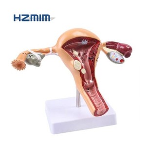Модель обучения медицинской науке пластиковая модель влагалища матки - Product Image 5