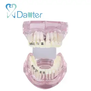 New Arrival Dental Orthodontic Model with Metal and Ceramic Bracket