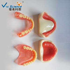 Mô hình giáo dục khoa học y tế răng giả mô hình răng người mô hình cấy ghép răng giả đầy đủ - Product Image 5