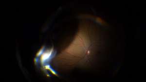 Système BIOM manuel économique pour <span class=keywords><strong>microscope</strong></span> <span class=keywords><strong>chirurgical</strong></span> ophtalmique - Product Image 2