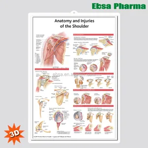 3D الطبية التشريح البشري الرسوم البيانية الجدار/ملصق-التشريح و إصابات الكتف