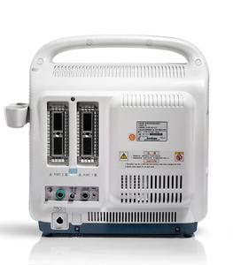 Sonoscape s2 휴대용 sonoscape 컬러 도플러 초음파 <span class=keywords><strong>usg</strong></span> - Product Image 2