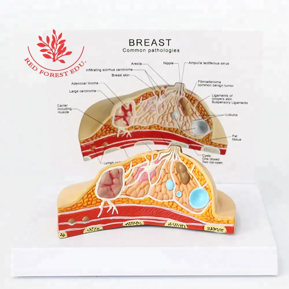 Model Bagian Penyakit Kanker Payudara, Model Ilmu Anatomi Manusia, Ilmu Kedokteran, Komunikasi Pasien