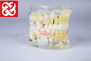 Mezcla de dentición modelo dental con los dientes permanentes y desdentado dientes de bebé y de retención - Product Image 3