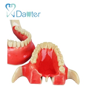Hoge Kwaliteit Ortho Implantaat Praktijk Model Hars Materiaal - Product Image 4
