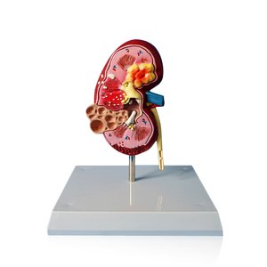 Modè<span class=keywords><strong>le</strong></span> d'anatomie rénale: conditions normales <span class=keywords><strong>et</strong></span> pathologiques - Product Image 1
