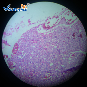 Lames préparées au microscope 48 pièces lames de pathologie buccale préparées au microscope pour l'enseignement de la pathologie en sciences médicales - Product Image 5