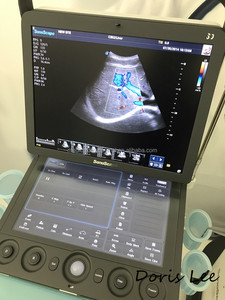 Mesin <span class=keywords><strong>Ultrasound</strong></span> Doppler Warna Portabel, Versi Model Terbaru, <span class=keywords><strong>SonoScape</strong></span> <span class=keywords><strong>S9</strong></span> - Product Image 2
