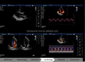 Appareil d'échographie portable 2D Sonoscape S9 Prix/ecografo - Product Image 4
