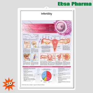 3D médicos humanos anatomía pared gráficos/cartel-La infertilidad - Product Image 1