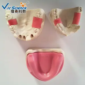 Operación de implante Dental, modelos de entrenamiento dental, dientes humanos, modelo educativo de ciencia médica