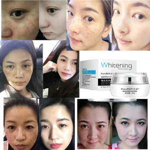 Crema Aclaradora de Pecas OEM de 7 Días, Elimina la Melanina, Pecas, Manchas Oscuras, Crema Blanqueadora Facial para Piel Negra - Product Image 3