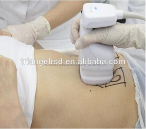 HIFU <span class=keywords><strong>Liposonix</strong></span> Cơ Thể Máy Giảm Béo, HIFU Siêu Âm Cơ Thể Máy Định Hình - Product Image 5