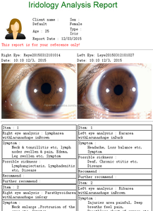 Venta caliente Sistema Detector de Iridología Cámara LED Innovación de de Análisis para La Piel Del Ojo Cuidado de La Salud Pelo - Product Image 6