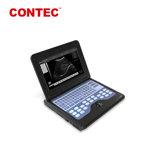CONTEC Sertifikasi CMS600P2 Pemindai <span class=keywords><strong>Ultrasound</strong></span> <span class=keywords><strong>Laptop</strong></span> Digital 10.1 Inci