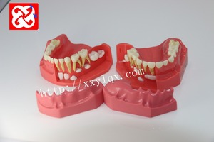 Mezcla de dentición pediátrica desarrollo dental modelo edad 3-6 - Product Image 4