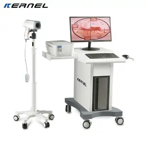 CE approved KERNEL KN2200 digital video colposcope for gynecology cervix vagina examination