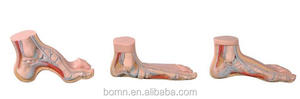 Santé des pieds et pieds anormaux (pieds normaux, pieds plats, pieds arqués) - Product Image 2