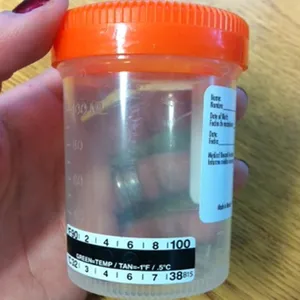 液晶尿標本カップ温度計ストリップ
