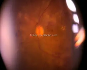 <span class=keywords><strong>Fundus</strong></span> görüntüleme görüntüleyici sistemi masaüstü yarık lamba - Product Image 1