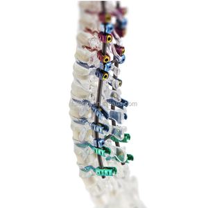<span class=keywords><strong>Cage</strong></span> de fusion thoracique-lombaire, implants orthopédiques en titane - Product Image 5