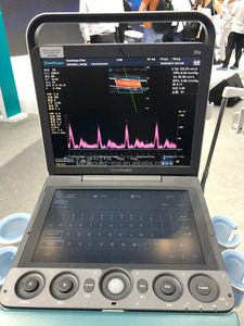SonoScape S9 Haut De gamme Porté Main Couleur Doppler Similaires à <span class=keywords><strong>Mindray</strong></span> <span class=keywords><strong>M7</strong></span> Machine À Ultrasons - Product Image 5