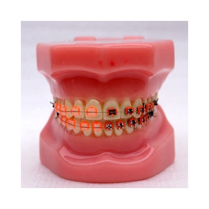 Modello dentale Ortodontico Con staffe in metallo - Product Image 4