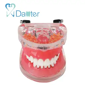 Tandheelkundige Parodontale Model met Vervanging Gingivae Dental Onderwijs Model