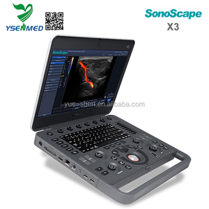 Alat USG Vaskular Portabel <span class=keywords><strong>Sonoscape</strong></span> X3 Doppler Warna Termurah dan Terpopuler - Product Image 3
