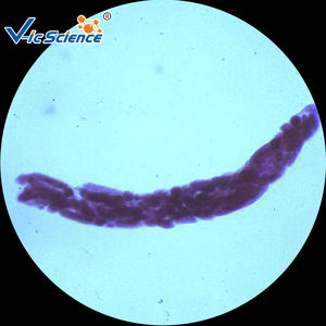 Ilmu Pengetahuan Medis Parasitologi Set Campuran Disiapkan Slide Parasit Mikroskop Disiapkan Slide - Product Image 2