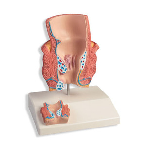 Gelsonlab HSBM-298 <span class=keywords><strong>Model</strong></span> Arteri Anatomi dan Pembuluh Darah untuk <span class=keywords><strong>Model</strong></span> Pengajaran Medis - Product Image 4
