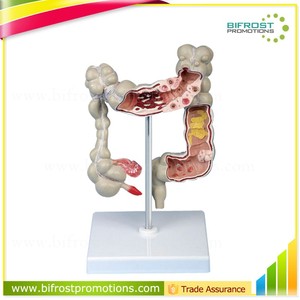 Modelo de Colon para Patología, Órganos del <span class=keywords><strong>Cuerpo</strong></span> <span class=keywords><strong>Humano</strong></span>, Anatomía - Product Image 1