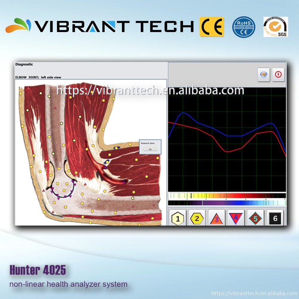 Bioresonance Scan et Thérapie machine NLS Metatron Hunter 4025