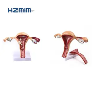 human anatomical uterus model, female womb model with pathology, Uterus model for teaching