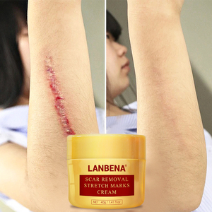 LANBENA stretch mark acné cicatriz eliminación crema pockmark de reparación - Product Image 3