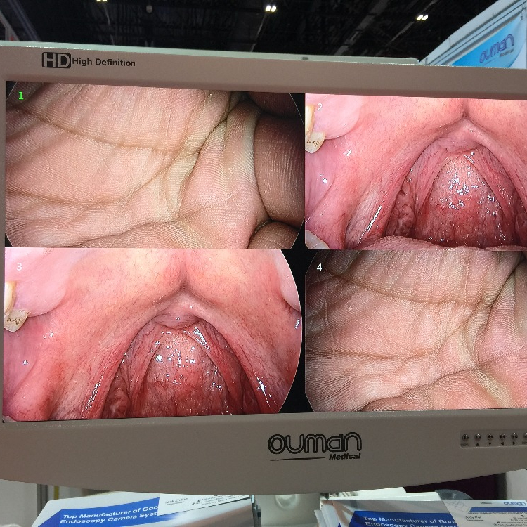 Медицинский СВЕТОДИОДНЫЙ монитор