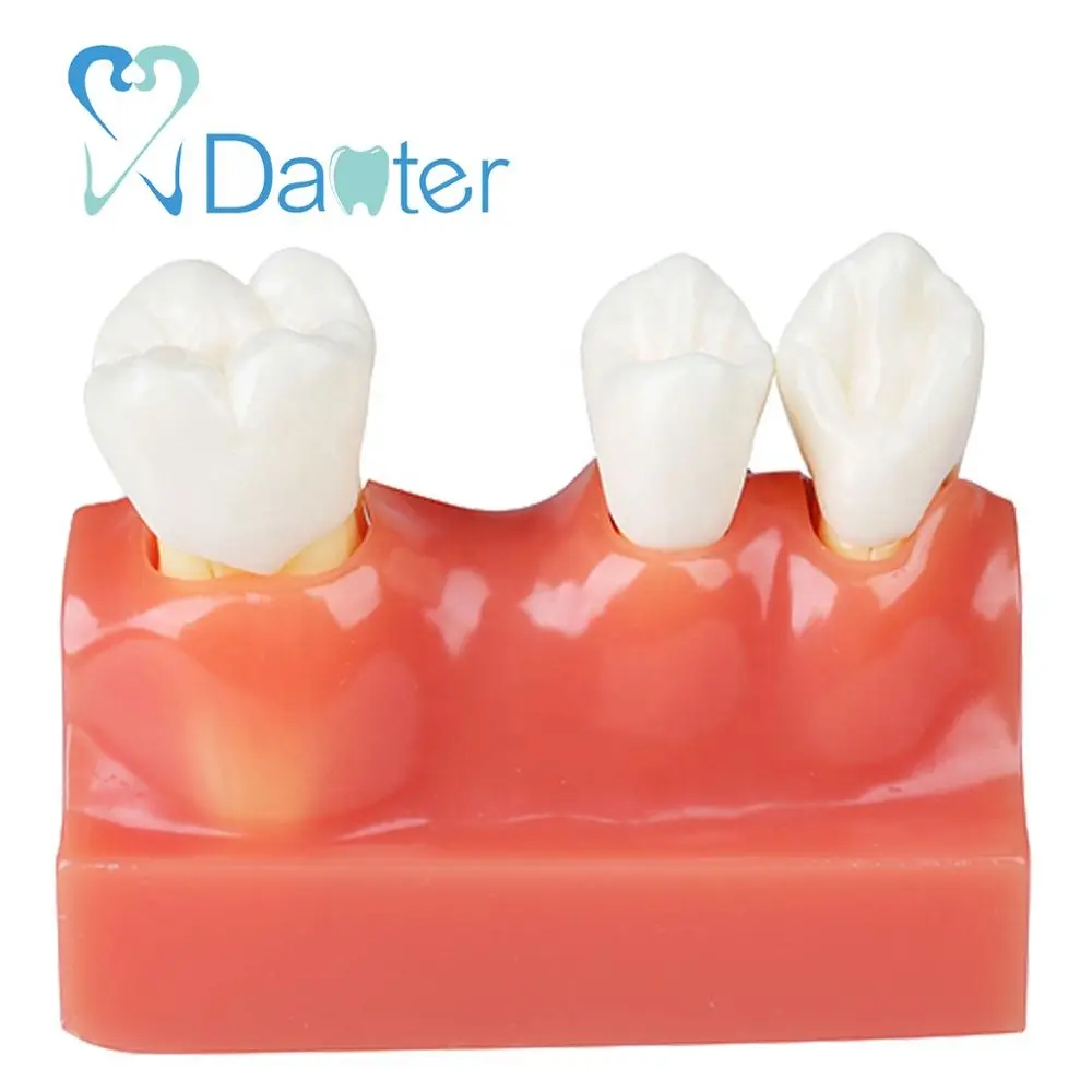 歯内療法と歯の解剖学を説明するための新しいタイプの4倍解剖学モデル