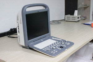 Giá Máy Siêu Âm Sonosape S2/Doppler Màu - Product Image 5