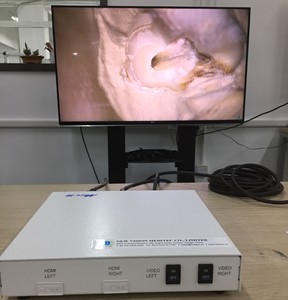 4K 3D ビデオシステム 3D カメラ 3D テレビ 3D モジュール 眼科ライブ手術録画用 - Product Image 5