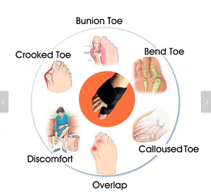 Korektor Jempol Bunion, Pelindung Bunion-Meringankan Nyeri Kaki Hallux Valgus, Menenangkan Bunion Nyeri - Product Image 4